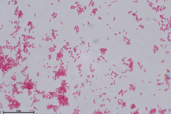 E-coli-Gram-alumnos-Jazz-2.2