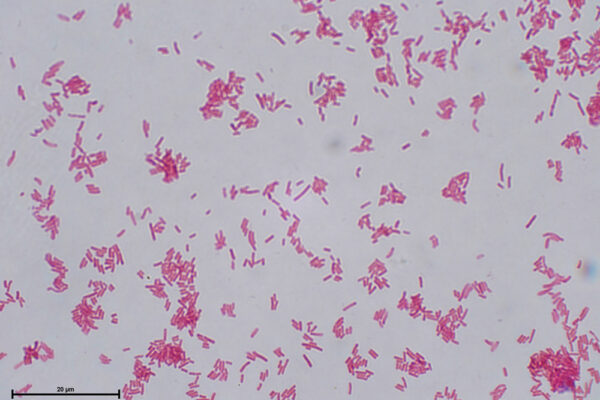 E-coli-Gram-alumnos-Jazz-3