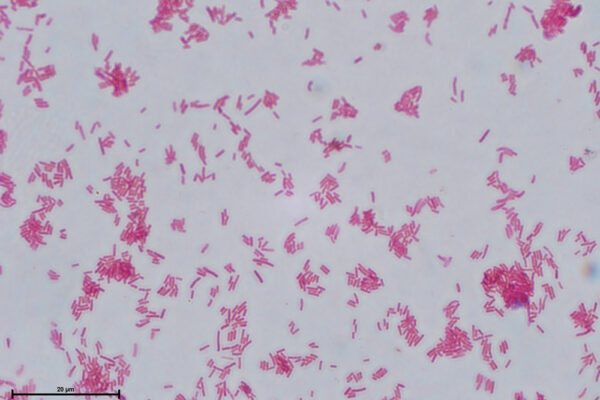 E-coli-Gram-alumnos-Jazz-4