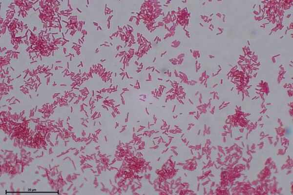 E-coli-Gram-alumnos-Jazz
