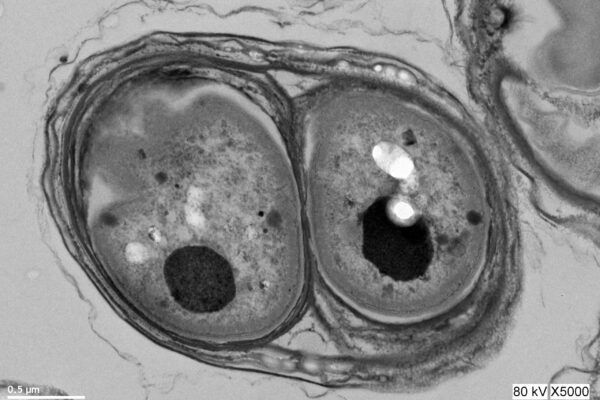 Gloeobacter