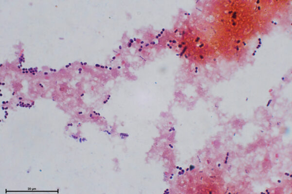 Kefir-2