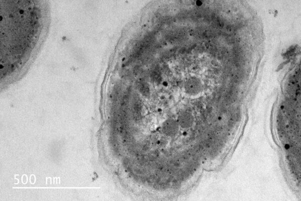 SynechococcalAlchichica