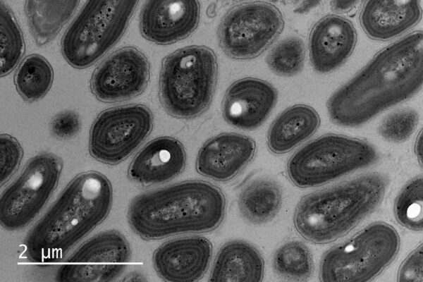SynechococcalAlchichica2