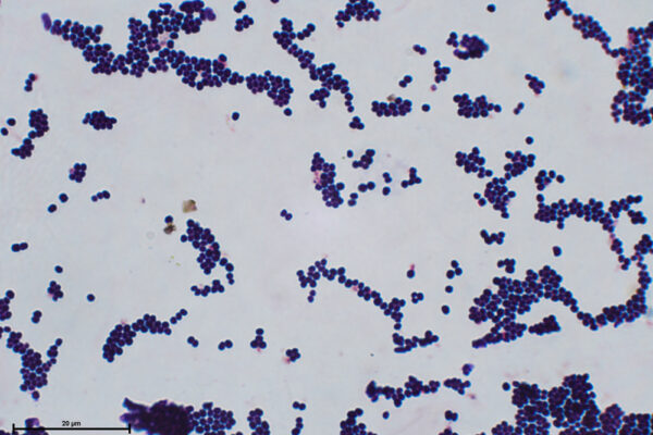 Micrococcus-G+-Alumnos-Jazz